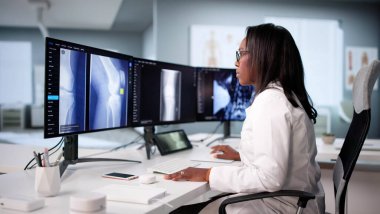 Yetenekli Afro-Amerikan Doktor Ameliyattan önce diz röntgeni çekti.