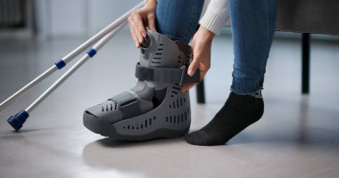 Eklem kırığı yaralanmasından sonra kırık bacak tedavisi gören bir kadın. Muhtemel Meslekler: Hemşire, Fizyoterapist