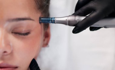 Uzman Dermatolog, Genç Kadın 'a Kırışıklık Azaltıcı Güzellik Tedavisi Yapıyor