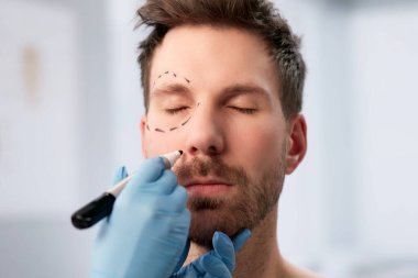 Estetik Cerrah, Erkek Hastaların Kozmetik Prosedürden Önce Karşılaşacakları Özetle Özetliyor