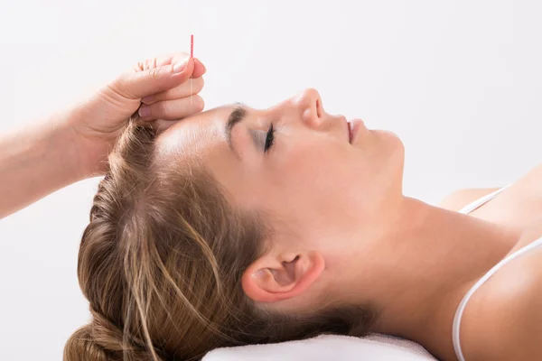 Hand Performing Acupuncture Therapy On Head — Stock Photo, Image