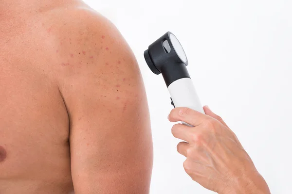 Doutor verificando a pele da acne de um homem — Fotografia de Stock