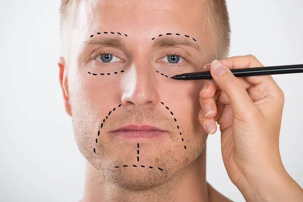 Man's Face With Correction Line — Stock Photo, Image