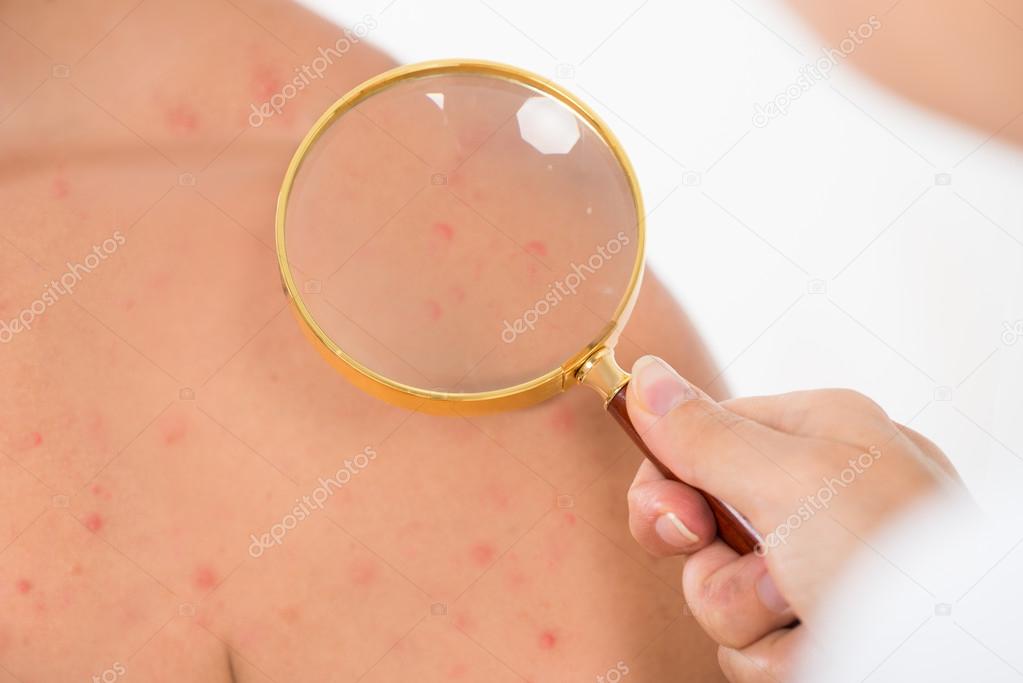 Examining Skin Acne Of Male Patient