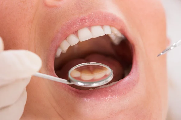 Female Patient Getting Dental Checkup — Stock Photo, Image