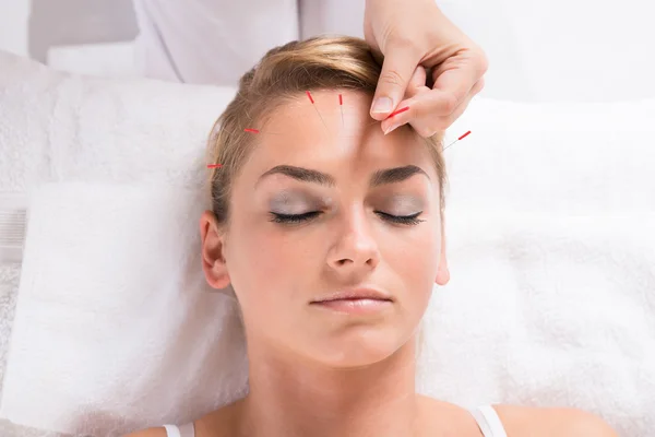 Performing Acupuncture Therapy On Patient's Head — Stock Photo, Image