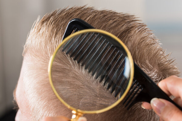 Доктор смотрит на волосы пациента
