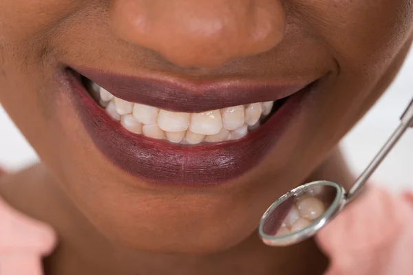 Mulher verificando seus dentes — Fotografia de Stock