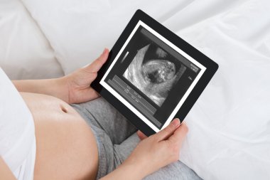 Ultra ses tarama ile hamile kadın