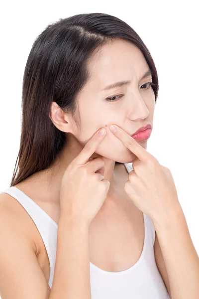 Mujer apretando espinillas — Foto de Stock