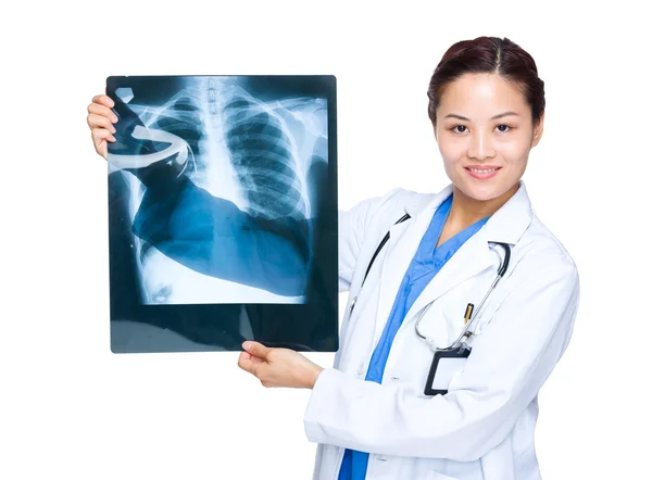 Doctora con rayos X — Foto de Stock