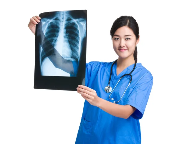 Азиатская молодая женщина врач с рентгеном — стоковое фото
