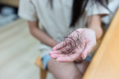 Dişi, doğumdan sonra büyük miktarda saç tutuyor.