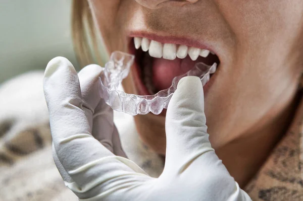 Gros Plan Patient Obtenant Contrôle Taille Des Dents Par Dentiste — Photo