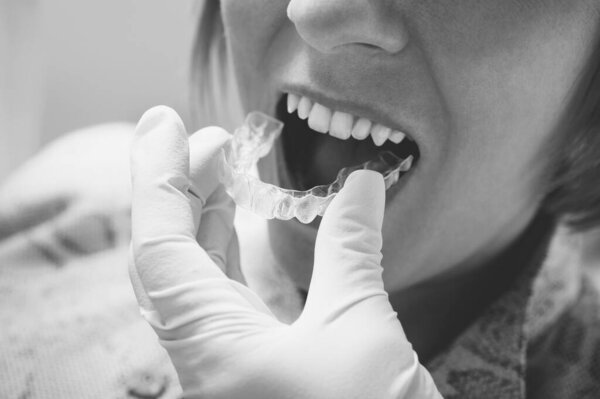 Woman Getting Dental Mold Made Royalty Free Stock Images