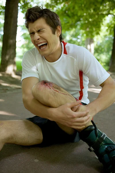 Skater injured and clutching leg — Stock Photo, Image