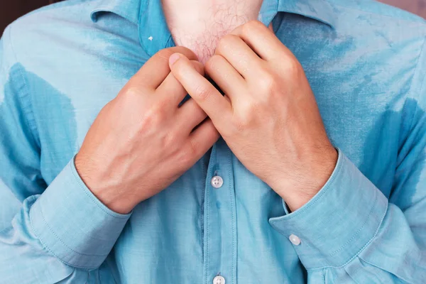 Problem with sweating - hyperhidrosis — Stock Photo, Image