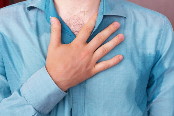 Problema con la sudoración - hiperhidrosis — Foto de Stock