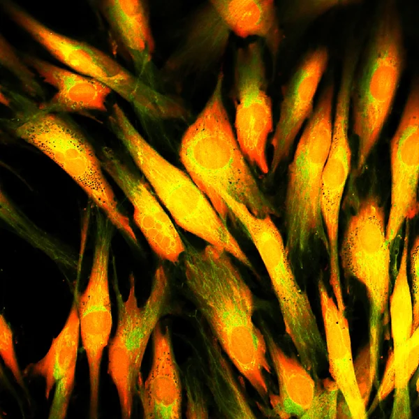 İnsan deri hücrelerinin gerçek Floresans mikroskobik görünümü