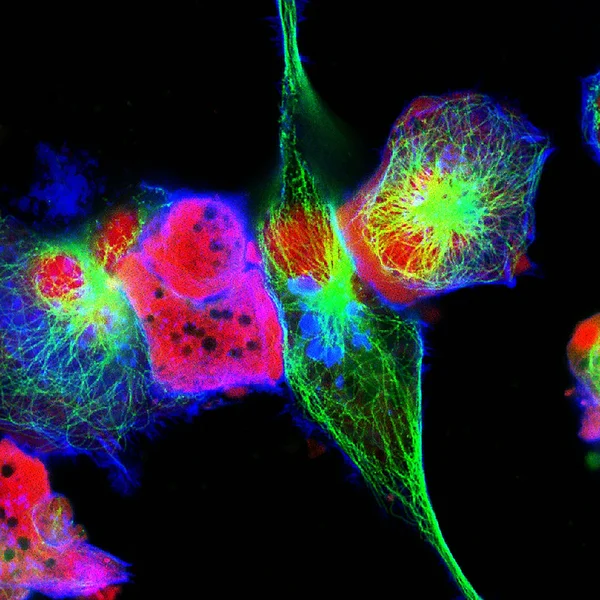 Visão microscópica de fluorescência real de células de neuroblastoma humano — Fotografia de Stock