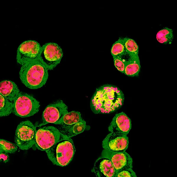 Vista microscópica de fluorescencia real de las células del neuroblastoma humano —  Fotos de Stock