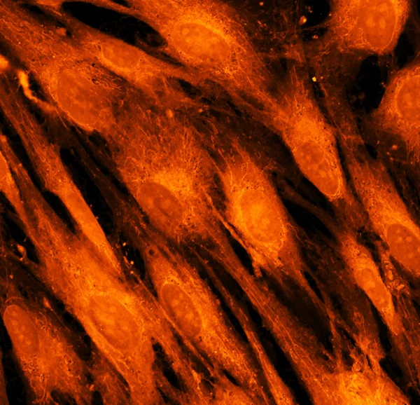 Реальный флуоресцентный микроскопический обзор клеток кожи человека — стоковое фото