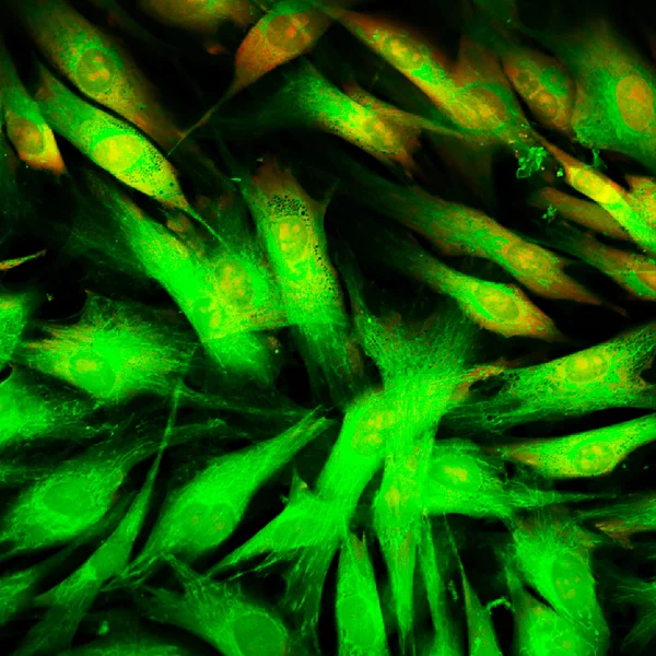 Vista microscopica a fluorescenza reale delle cellule cutanee umane — Foto Stock