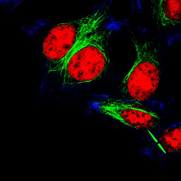 Visão microscópica de fluorescência real da linha celular HeLa — Fotografia de Stock