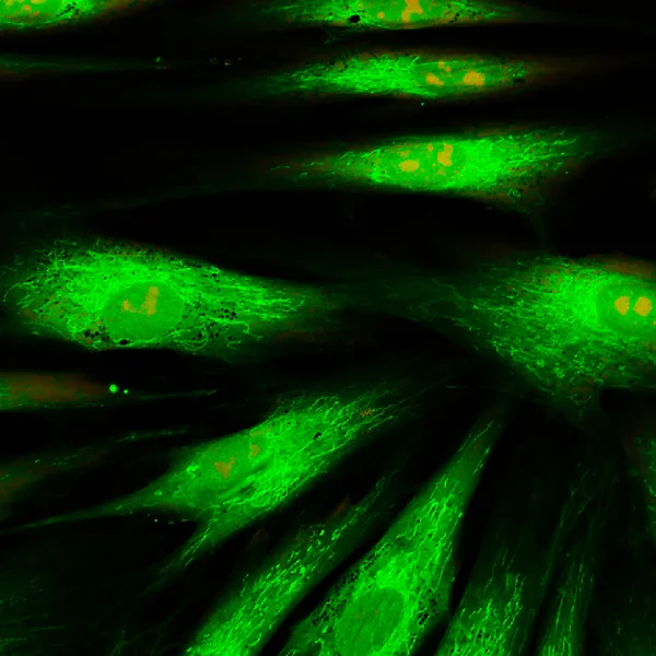 Visão microscópica de fluorescência real de células da pele humana — Fotografia de Stock