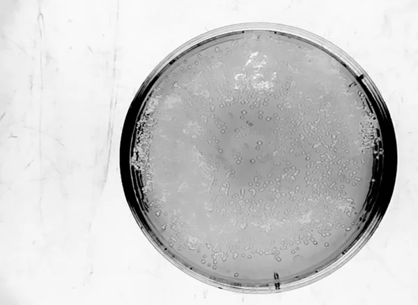E. coli bacteria colonies growing on the plate — Stock Photo, Image