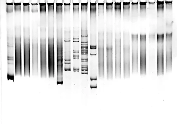 Mutatie screening in polyacrylamidegel — Stockfoto