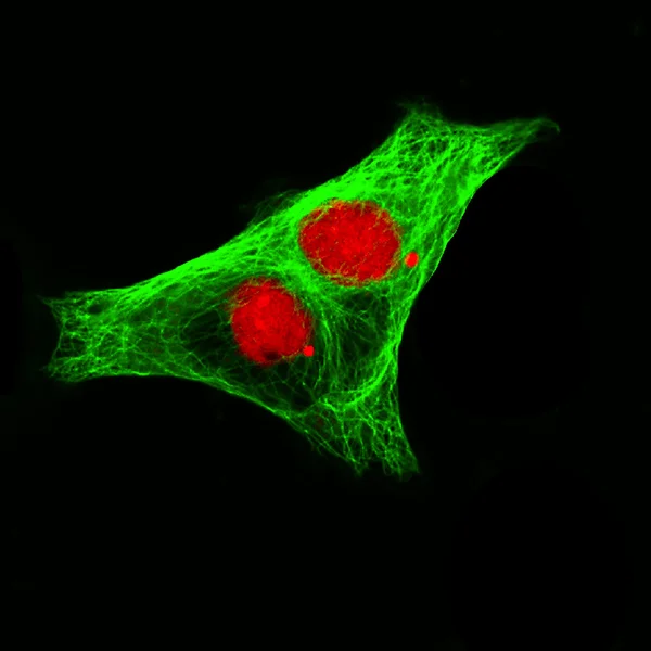 Vista microscópica de fluorescencia real de las células del neuroblastoma humano —  Fotos de Stock