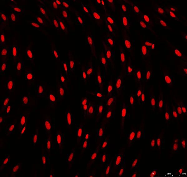 Microscopie confocale des noyaux de fibroblastes — Photo