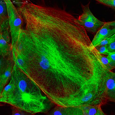 Fibroblast hücre confocal mikroskobu