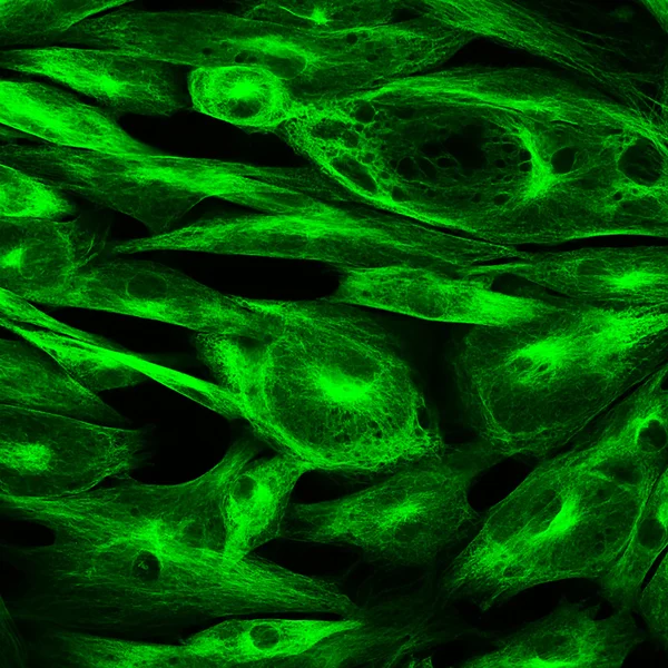 Konfokalmikroskopi fibroblast celler — Stockfoto