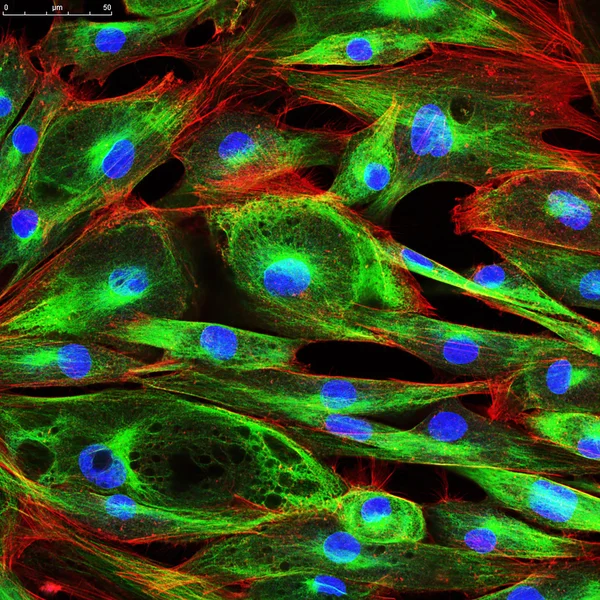 Fibroblast hücre confocal mikroskobu
