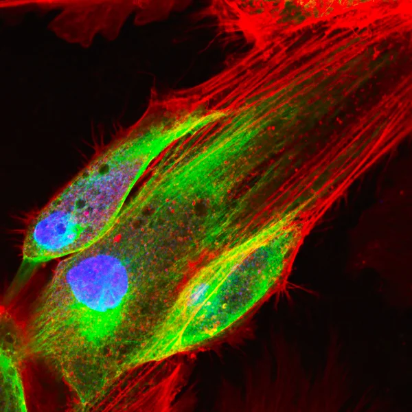 Microscopia confocal de células fibroblásticas — Fotografia de Stock