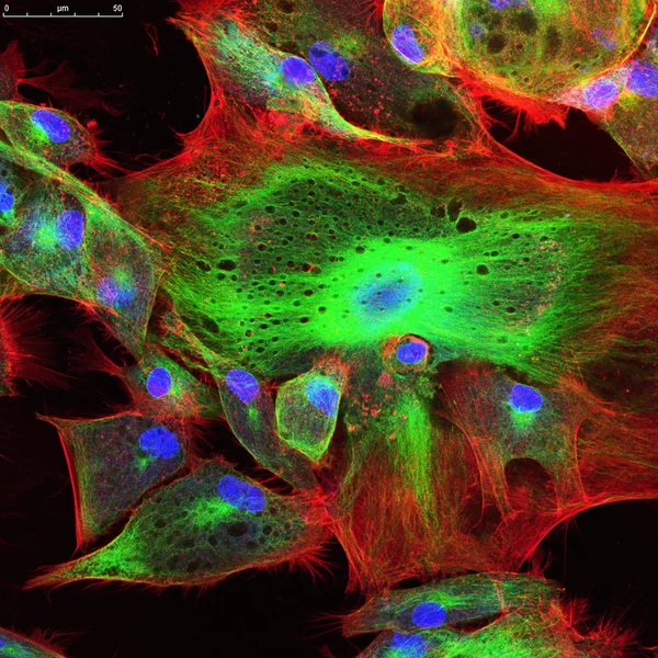 Microscopia confocal de células fibroblásticas — Fotografia de Stock