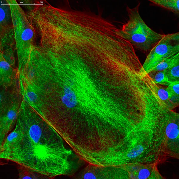 Microscopie confocale des fibroblastes — Photo