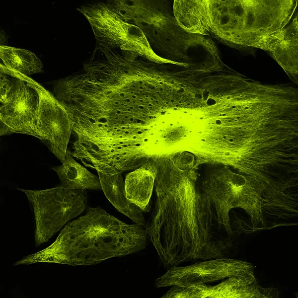 Microscopie confocale des fibroblastes — Photo