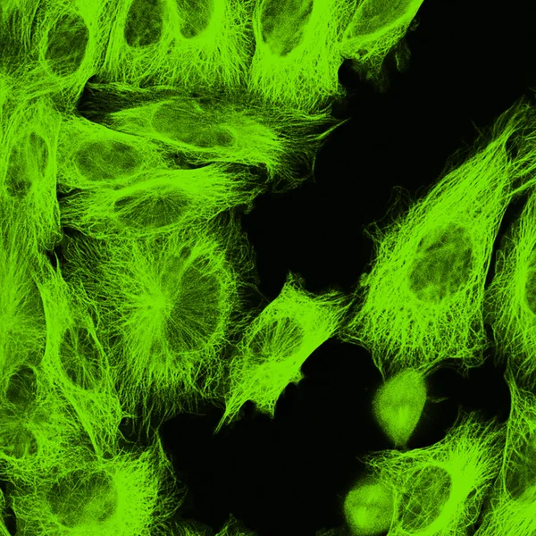 Mikroskopia konfokalna komórek fibroblastów — Zdjęcie stockowe