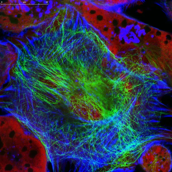 Vista microscopica di fluorescenza reale della linea cellulare del neuroblastoma dei topi — Foto Stock