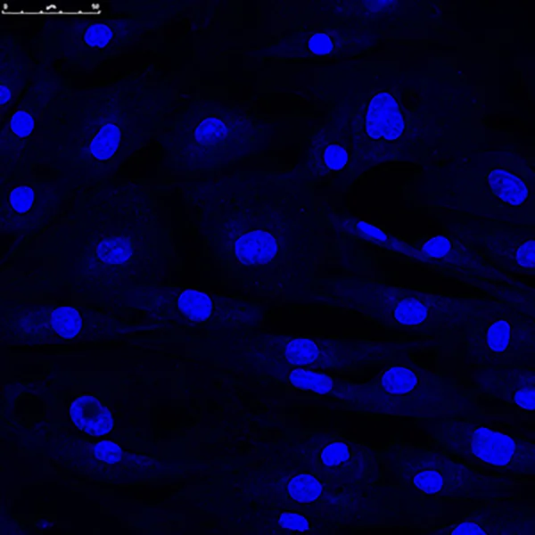 Microscopia confocal de núcleos de fibroblastos — Fotografia de Stock