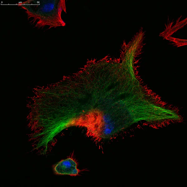 Microscopie confocale des fibroblastes — Photo