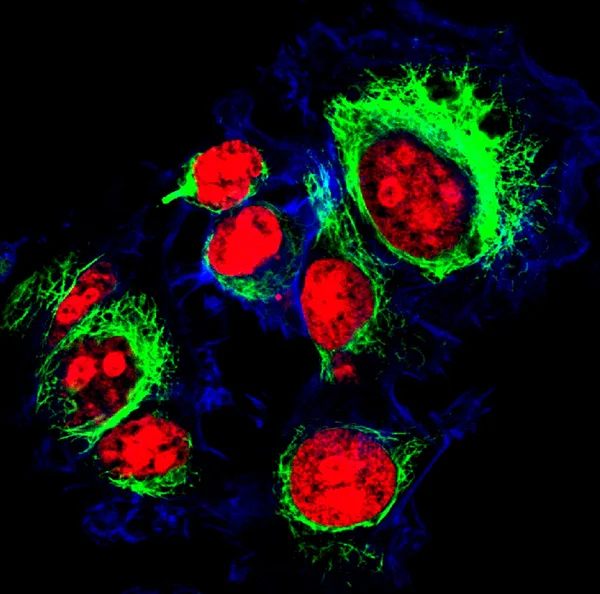 Ovariale kankercellen aangeduid met fluorescerende moleculen — Stockfoto