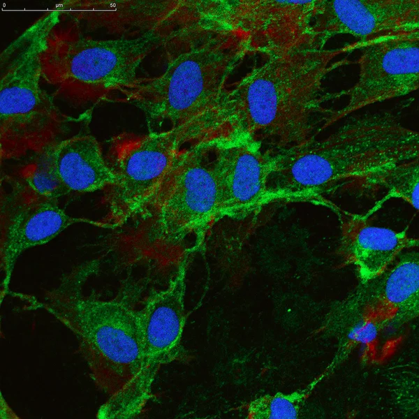 Bindvävsstamceller som är märkta med fluorescerande molekyler — Stock fotografie