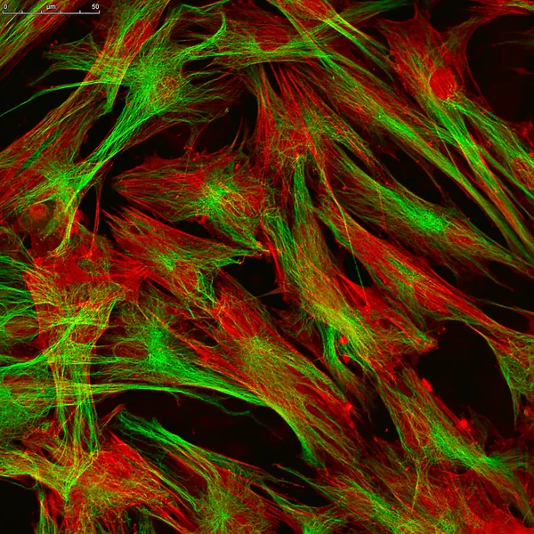 Fibroblastes (cellules de la peau) marqués avec des colorants fluorescents — Photo