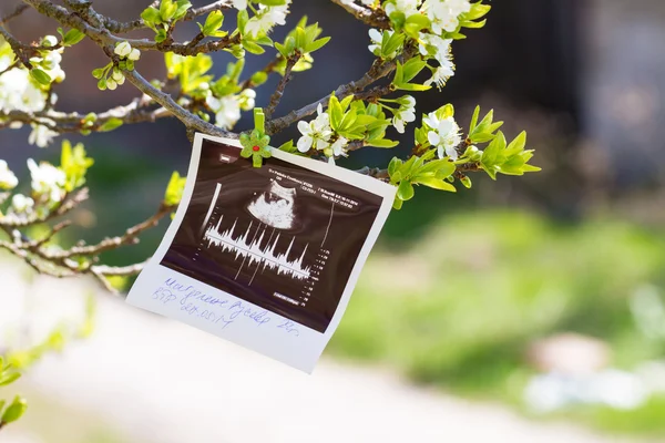 Ultrazvukový obraz a rodiče — Stock fotografie