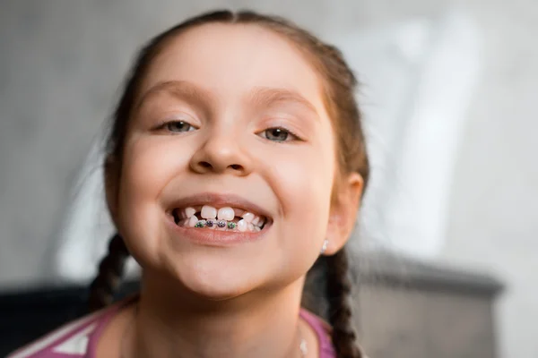 Ragazza con apparecchio dentale — Foto Stock