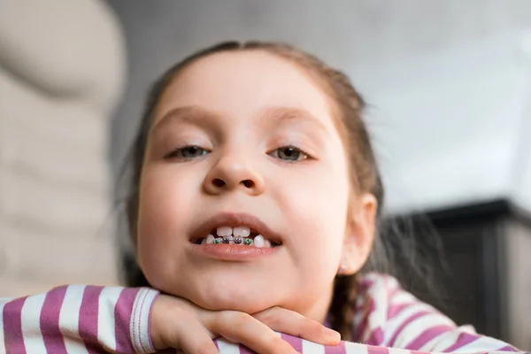 Ragazza con apparecchio dentale — Foto Stock